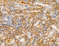 Invitrogen MLKL Polyclonal Antibody 100 &mu;L | Buy Online | Invitrogen&trade; | Fisher Scientific