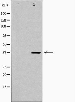 Invitrogen LSP1 Polyclonal Antibody 100 &mu;L; Unconjugated:Antibodies,
