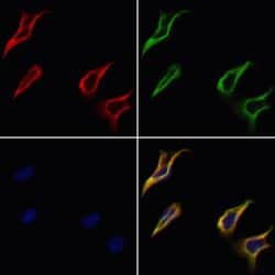Invitrogen PLTP Polyclonal Antibody 100 &mu;L | Buy Online | Invitrogen&trade; | Fisher Scientific