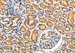 Invitrogen PLTP Polyclonal Antibody 100 &mu;L | Buy Online | Invitrogen&trade; | Fisher Scientific