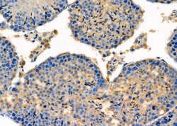 Invitrogen PLTP Polyclonal Antibody 100 &mu;L | Buy Online | Invitrogen&trade; | Fisher Scientific