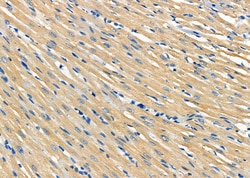 Invitrogen PLTP Polyclonal Antibody 100 &mu;L | Buy Online | Invitrogen&trade; | Fisher Scientific