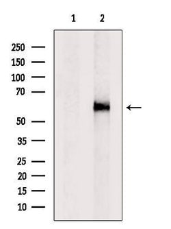 Invitrogen PLTP Polyclonal Antibody 100 &mu;L | Buy Online | Invitrogen&trade; | Fisher Scientific