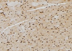 PSMB4 Polyclonal Antibody:Antibodies, Polyclonal