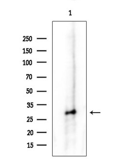 PSMB4 Polyclonal Antibody:Antibodies, Polyclonal