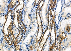 Invitrogen ATP1B1 Polyclonal Antibody 100 &mu;L; Unconjugated:Antibodies,