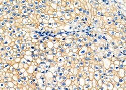 Invitrogen ATP1B1 Polyclonal Antibody 100 &mu;L; Unconjugated:Antibodies,