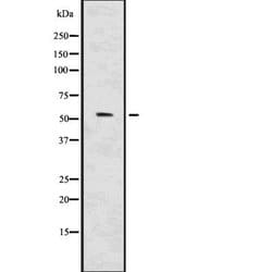 Invitrogen IRF7 Polyclonal Antibody 100 &mu;L; Unconjugated:Antibodies,