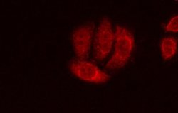 Invitrogen TRPM7 Polyclonal Antibody 100 &mu;L; Unconjugated:Antibodies,