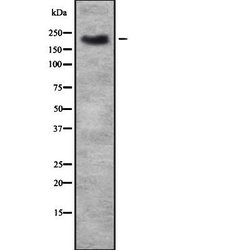 Invitrogen TRPM7 Polyclonal Antibody 100 &mu;L; Unconjugated:Antibodies,