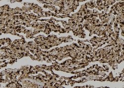Invitrogen LATS2 Polyclonal Antibody 100 &mu;L; Unconjugated:Antibodies,