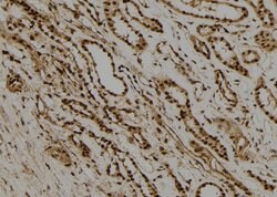 RAD21 Polyclonal Antibody, Invitrogen&trade;
