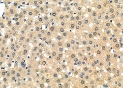 RAD21 Polyclonal Antibody, Invitrogen&trade;
