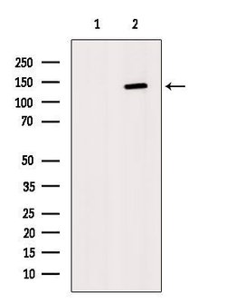 RAD21 Polyclonal Antibody, Invitrogen&trade;