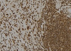 Invitrogen Claspin Polyclonal Antibody 100 &mu;L; Unconjugated:Antibodies,