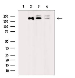 Invitrogen RICTOR Polyclonal Antibody 100 &mu;L | Buy Online | Invitrogen&trade; | Fisher Scientific