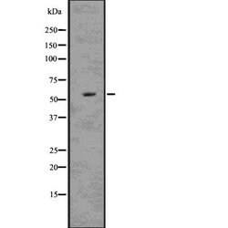 Invitrogen MDMX Polyclonal Antibody 100 &mu;L; Unconjugated:Anticuerpos