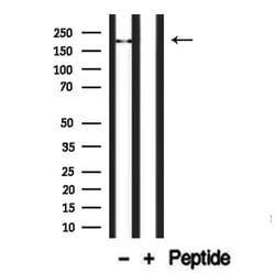 Invitrogen TRPM2 Polyclonal Antibody 100 &mu;L | Buy Online | Invitrogen&trade; | Fisher Scientific
