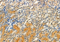 Invitrogen CSNK2B Polyclonal Antibody 100 &mu;L; Unconjugated:Antibodies,