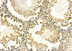 Invitrogen CSNK2B Polyclonal Antibody 100 &mu;L; Unconjugated:Antibodies,
