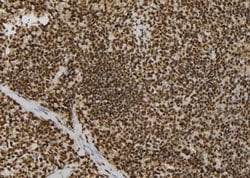 Invitrogen CSNK2B Polyclonal Antibody 100 &mu;L; Unconjugated:Antibodies,