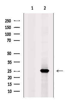Invitrogen CSNK2B Polyclonal Antibody 100 &mu;L; Unconjugated:Antibodies,