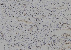 Invitrogen HES1 Polyclonal Antibody 100 &mu;L; Unconjugated:Antibodies,