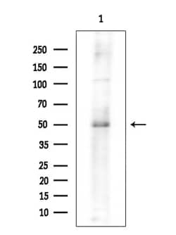 Invitrogen WNT10A Polyclonal Antibody 100 &mu;L; Unconjugated:Antibodies,