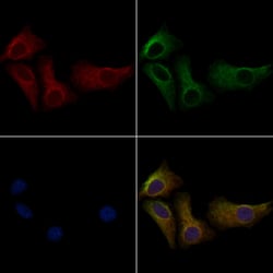 Phospho-PERK (Thr982) Polyclonal Antibody:Antibodies, Polyclonal