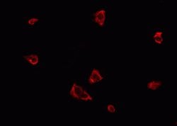 Phospho-PERK (Thr982) Polyclonal Antibody:Antibodies, Polyclonal