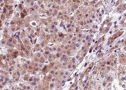 Phospho-PERK (Thr982) Polyclonal Antibody:Antibodies, Polyclonal