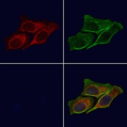 Invitrogen RAB10 Polyclonal Antibody 100 &mu;L; Unconjugated:Antibodies,