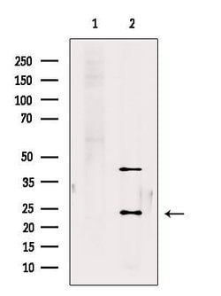 Invitrogen RAB10 Polyclonal Antibody 100 &mu;L; Unconjugated:Antibodies,