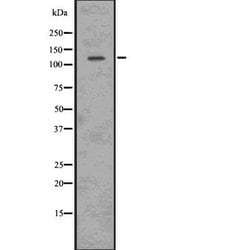Invitrogen Phospho-ULK1 (Ser556) Polyclonal Antibody 100 &mu;L; Unconjugated:Antibodies,