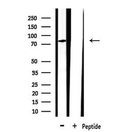 Invitrogen CLCN3 Polyclonal Antibody 100 &mu;L | Buy Online | Invitrogen&trade; | Fisher Scientific