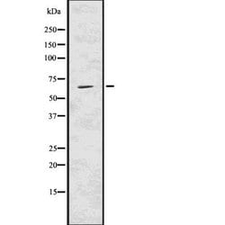 Invitrogen USP22 Polyclonal Antibody 100 &mu;L; Unconjugated:Antibodies,