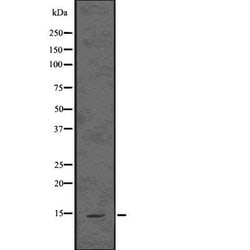 ASIP Polyclonal Antibody:Antibodies, Polyclonal