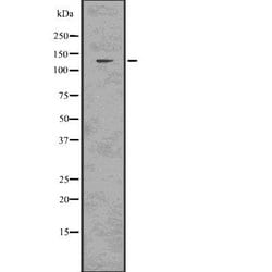 Invitrogen CARD11 Polyclonal Antibody 100 &mu;L | Buy Online | Invitrogen&trade; | Fisher Scientific