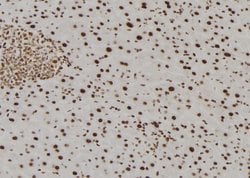 Invitrogen TMX2 Polyclonal Antibody 100 &mu;L | Buy Online | Invitrogen&trade; | Fisher Scientific