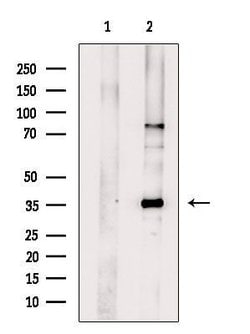 Invitrogen TMX2 Polyclonal Antibody 100 &mu;L | Buy Online | Invitrogen&trade; | Fisher Scientific