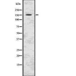 Invitrogen C11orf30 Polyclonal Antibody 100 &mu;L | Buy Online | Invitrogen&trade; | Fisher Scientific