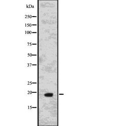 Invitrogen IL-15 Polyclonal Antibody 100 &mu;L; Unconjugated:Antibodies,
