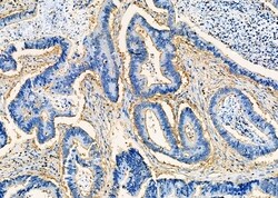 Invitrogen EPS15R Polyclonal Antibody 100 &mu;L; Unconjugated:Antibodies,