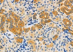 Invitrogen EPS15R Polyclonal Antibody 100 &mu;L; Unconjugated:Antibodies,
