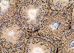 Invitrogen SUFU Polyclonal Antibody 100 &mu;L; Unconjugated:Antibodies,