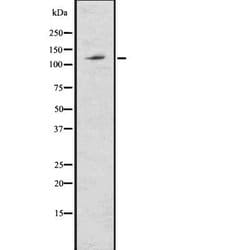 Invitrogen ABCG1 Polyclonal Antibody 100 &mu;L; Unconjugated:Antibodies,