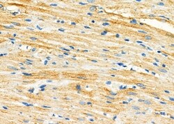 Invitrogen ARPC5 Polyclonal Antibody 100 &mu;L; Unconjugated:Antibodies,