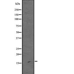 Invitrogen ARPC5 Polyclonal Antibody 100 &mu;L; Unconjugated:Antibodies,