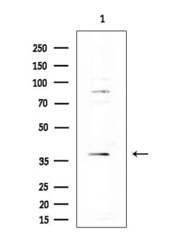 Invitrogen Amylin Polyclonal Antibody 100 &mu;L; Unconjugated:Antibodies,