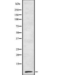Invitrogen Amylin Polyclonal Antibody 100 &mu;L; Unconjugated:Antibodies,